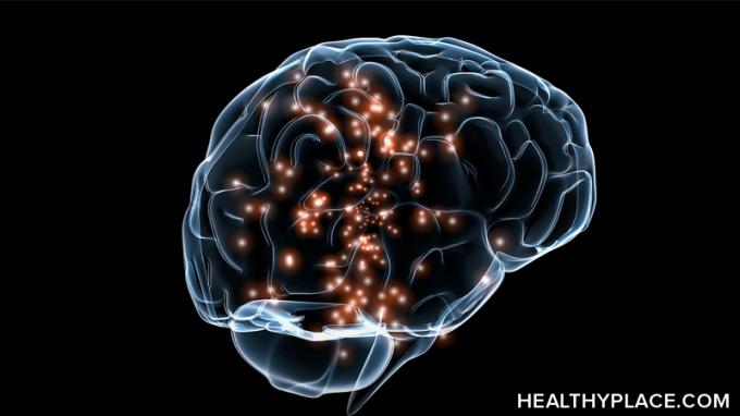 ניתן להשתמש בגירוי מגנטי transcranial חוזר (rTMS) לטיפול בדיכאון. למדו על טיפול ב- TMS וגירוי מגנטי של המוח.