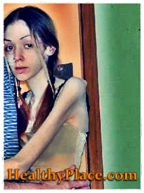 בתמונה זו של פגיעה עצמית, נערה עם אנורקסיה עוסקת גם בפגיעה עצמית על ידי חבטות וחבלות של חלקי גופה.